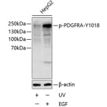 Western Blot - Anti-PDGFR alpha (Phospho Y1018) Antibody (A11091) - Antibodies.com