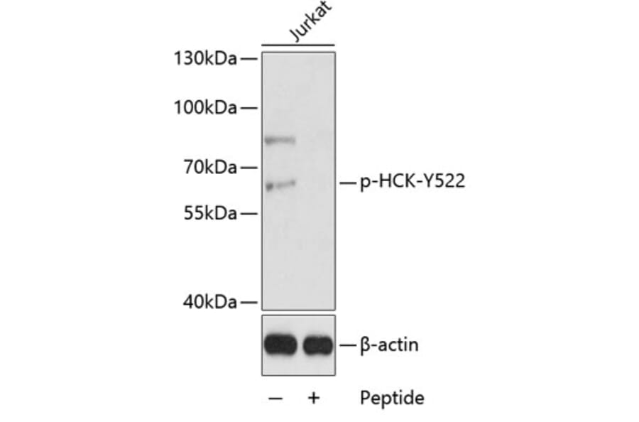 Western Blot - Anti-HCK (phospho Y522) Antibody (AP0620) - Antibodies.com