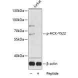 Western Blot - Anti-HCK (phospho Y522) Antibody (AP0620) - Antibodies.com