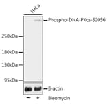 Western Blot - Anti-DNA PKcs (phospho Ser2056) Antibody (A11093) - Antibodies.com