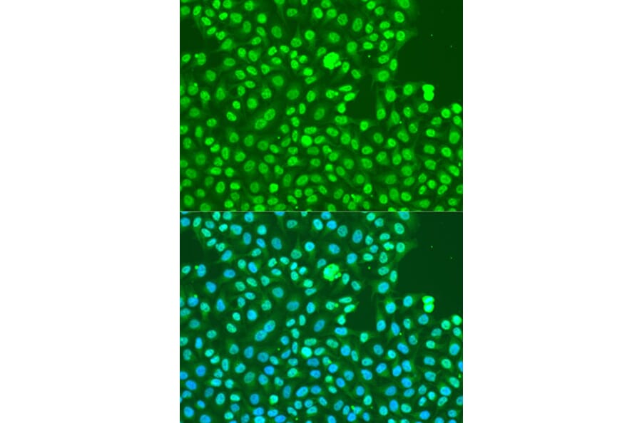 Immunofluorescence - Anti-DNA PKcs (phospho Ser2056) Antibody (A11093) - Antibodies.com