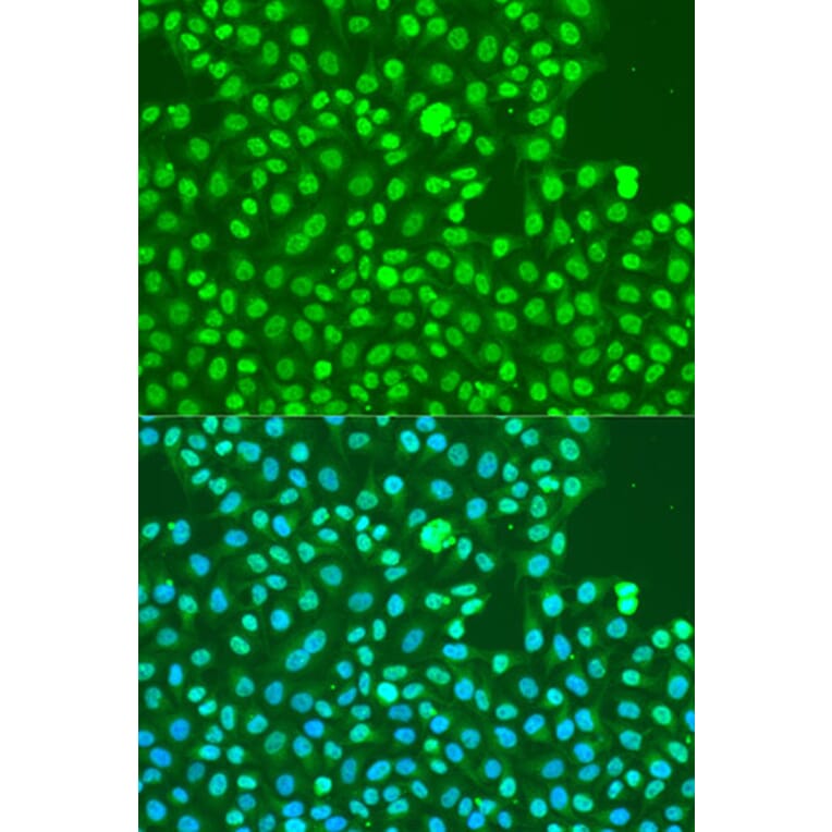 Immunofluorescence - Anti-DNA PKcs (phospho Ser2056) Antibody (A11093) - Antibodies.com