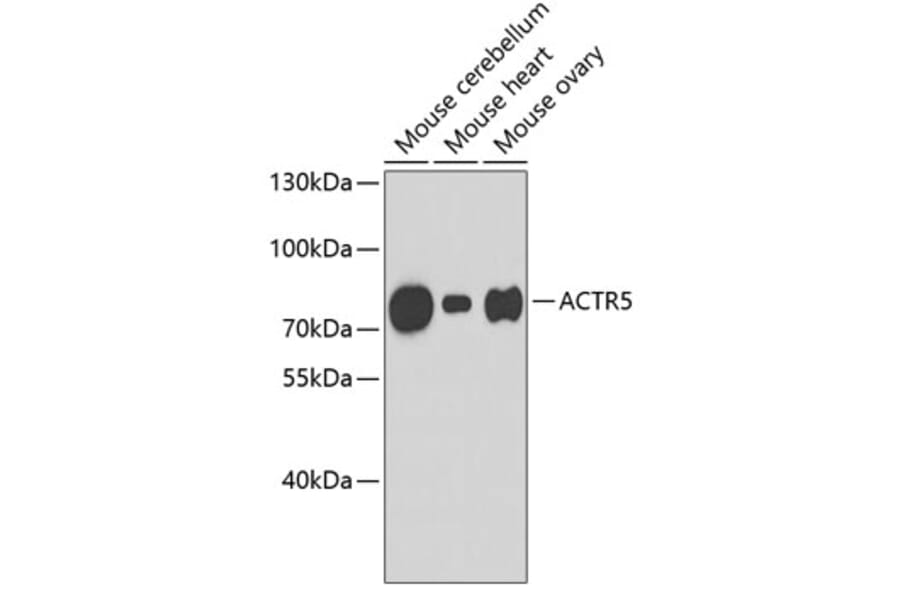 Western Blot - Anti-ACTR5 Antibody (A3505) - Antibodies.com