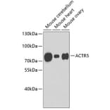 Western Blot - Anti-ACTR5 Antibody (A3505) - Antibodies.com