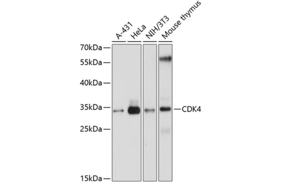 Western Blot - Anti-CDK4 Antibody (A0016) - Antibodies.com