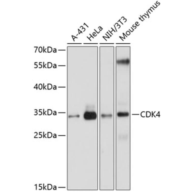Western Blot - Anti-CDK4 Antibody (A0016) - Antibodies.com