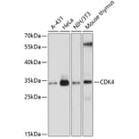 Western Blot - Anti-CDK4 Antibody (A0016) - Antibodies.com