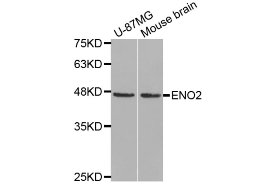 Western Blot - Anti-ENO2 Antibody (A0022) - Antibodies.com