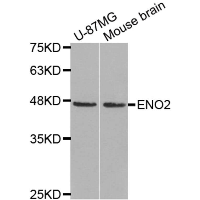 Western Blot - Anti-ENO2 Antibody (A0022) - Antibodies.com