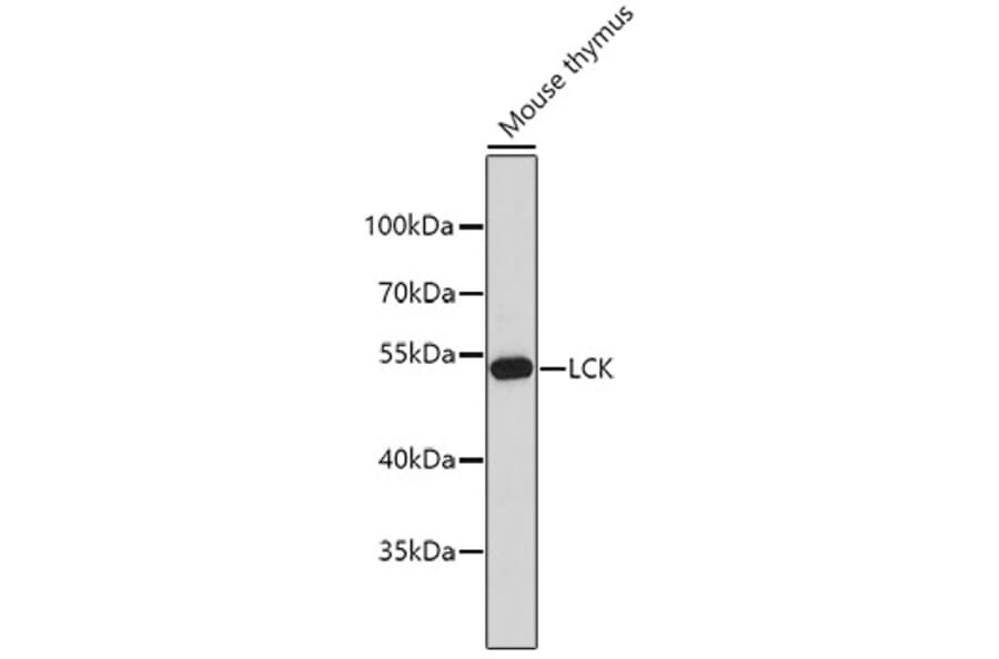 Western Blot - Anti-LCK Antibody (A0060) - Antibodies.com