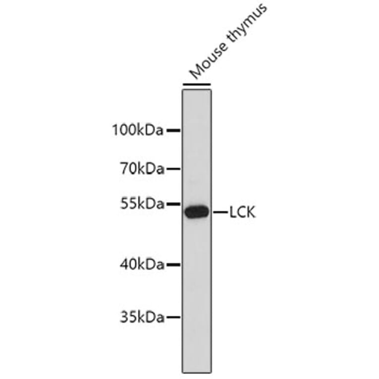 Western Blot - Anti-LCK Antibody (A0060) - Antibodies.com