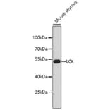 Western Blot - Anti-LCK Antibody (A0060) - Antibodies.com