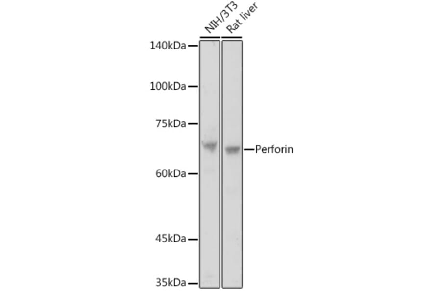 Western Blot - Anti-Perforin Antibody (A11105) - Antibodies.com