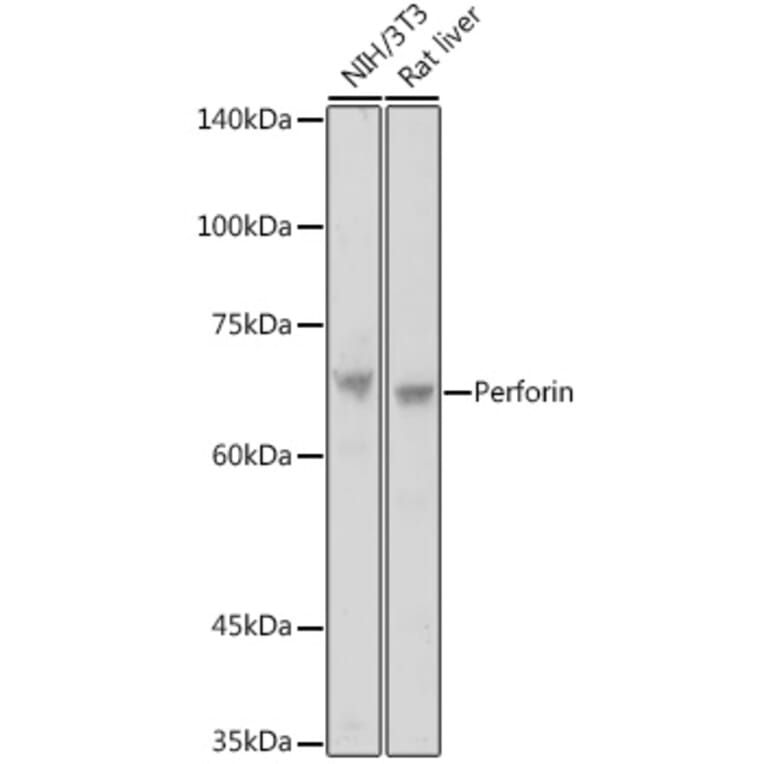 Western Blot - Anti-Perforin Antibody (A11105) - Antibodies.com