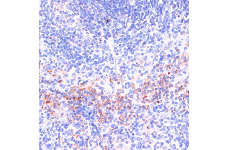 Immunohistochemistry - Anti-Perforin Antibody (A11105) - Antibodies.com