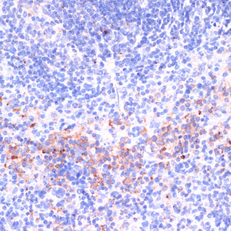 Immunohistochemistry - Anti-Perforin Antibody (A11105) - Antibodies.com