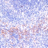 Immunohistochemistry - Anti-Perforin Antibody (A11105) - Antibodies.com