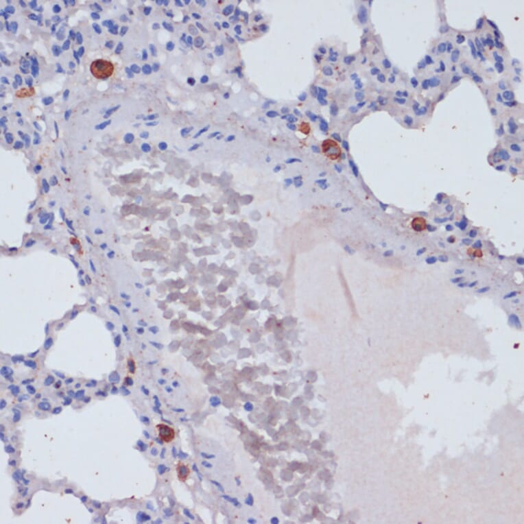 Immunohistochemistry - Anti-Perforin Antibody (A11105) - Antibodies.com