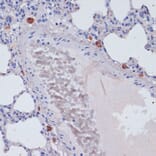 Immunohistochemistry - Anti-Perforin Antibody (A11105) - Antibodies.com