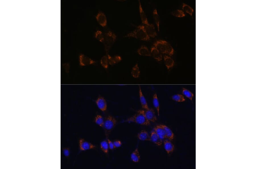 Immunofluorescence - Anti-Perforin Antibody (A11105) - Antibodies.com