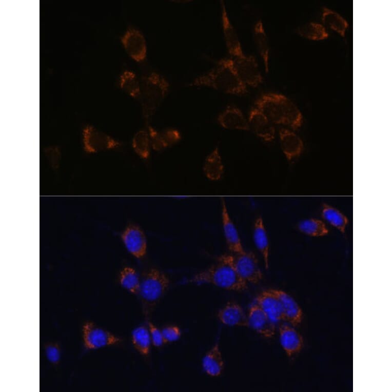 Immunofluorescence - Anti-Perforin Antibody (A11105) - Antibodies.com