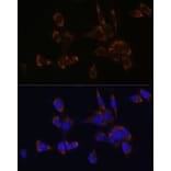 Immunofluorescence - Anti-Perforin Antibody (A11105) - Antibodies.com