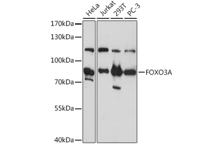 Western Blot - Anti-FOXO3A Antibody (A11106) - Antibodies.com