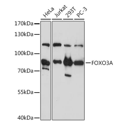 Western Blot - Anti-FOXO3A Antibody (A11106) - Antibodies.com
