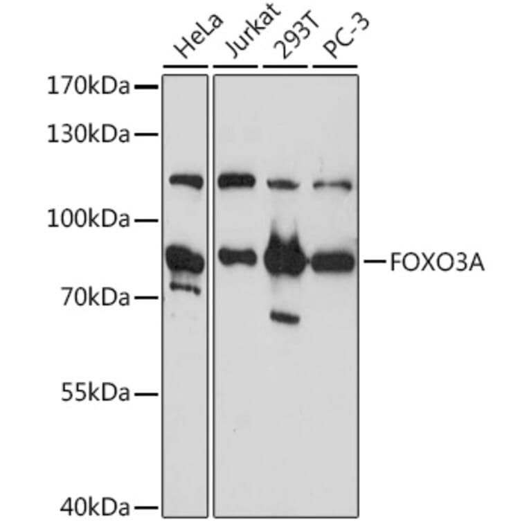 Western Blot - Anti-FOXO3A Antibody (A11106) - Antibodies.com