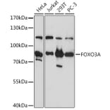 Western Blot - Anti-FOXO3A Antibody (A11106) - Antibodies.com