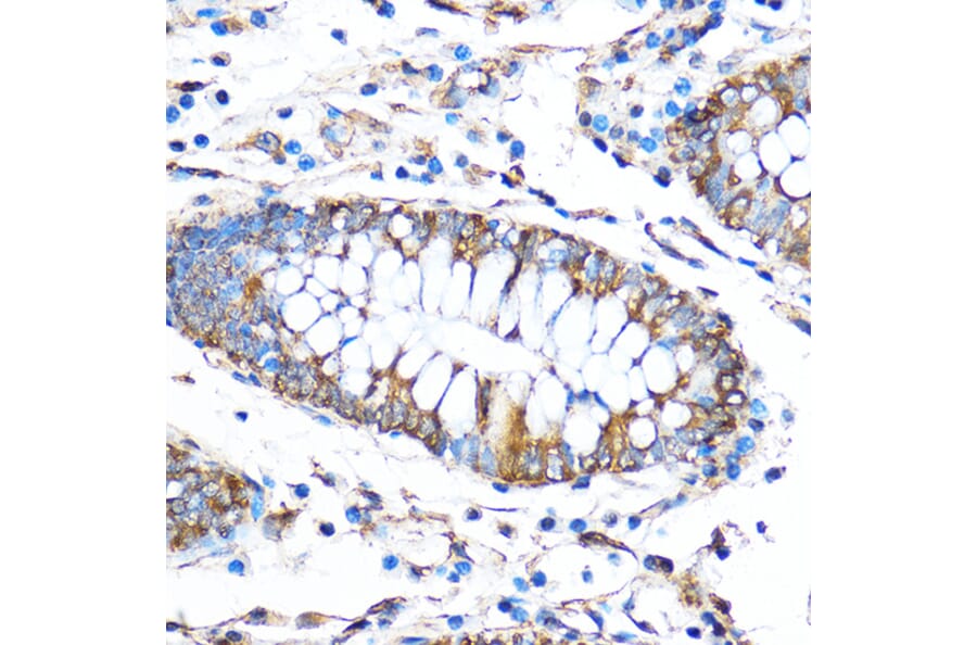 Immunohistochemistry - Anti-FOXO3A Antibody (A11106) - Antibodies.com