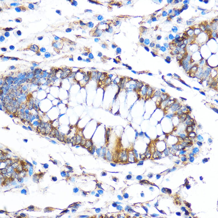 Immunohistochemistry - Anti-FOXO3A Antibody (A11106) - Antibodies.com