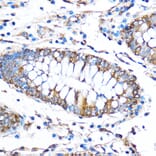 Immunohistochemistry - Anti-FOXO3A Antibody (A11106) - Antibodies.com