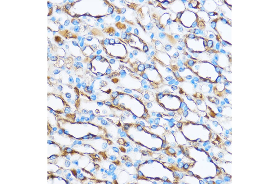 Immunohistochemistry - Anti-FOXO3A Antibody (A11106) - Antibodies.com