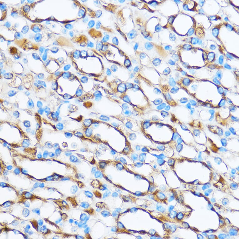 Immunohistochemistry - Anti-FOXO3A Antibody (A11106) - Antibodies.com
