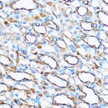 Immunohistochemistry - Anti-FOXO3A Antibody (A11106) - Antibodies.com