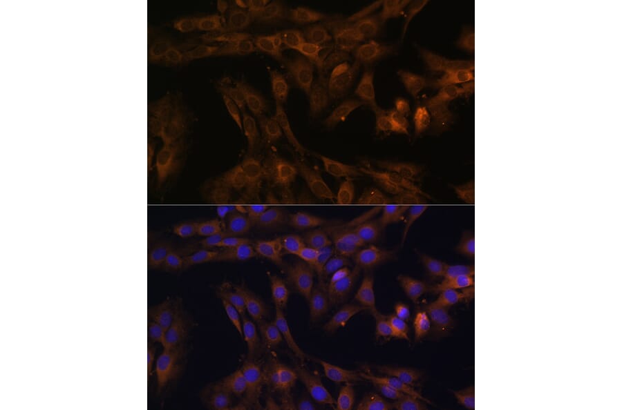 Immunofluorescence - Anti-FOXO3A Antibody (A11106) - Antibodies.com