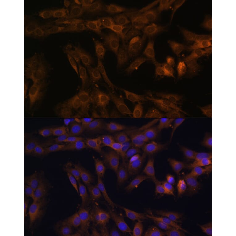 Immunofluorescence - Anti-FOXO3A Antibody (A11106) - Antibodies.com