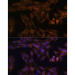 Immunofluorescence - Anti-FOXO3A Antibody (A11106) - Antibodies.com