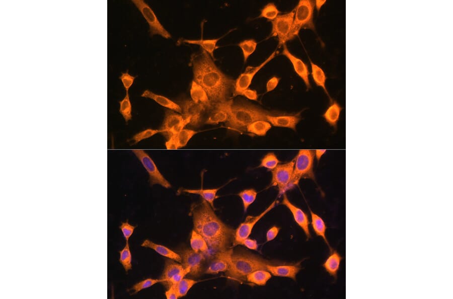 Immunofluorescence - Anti-FOXO3A Antibody (A11106) - Antibodies.com