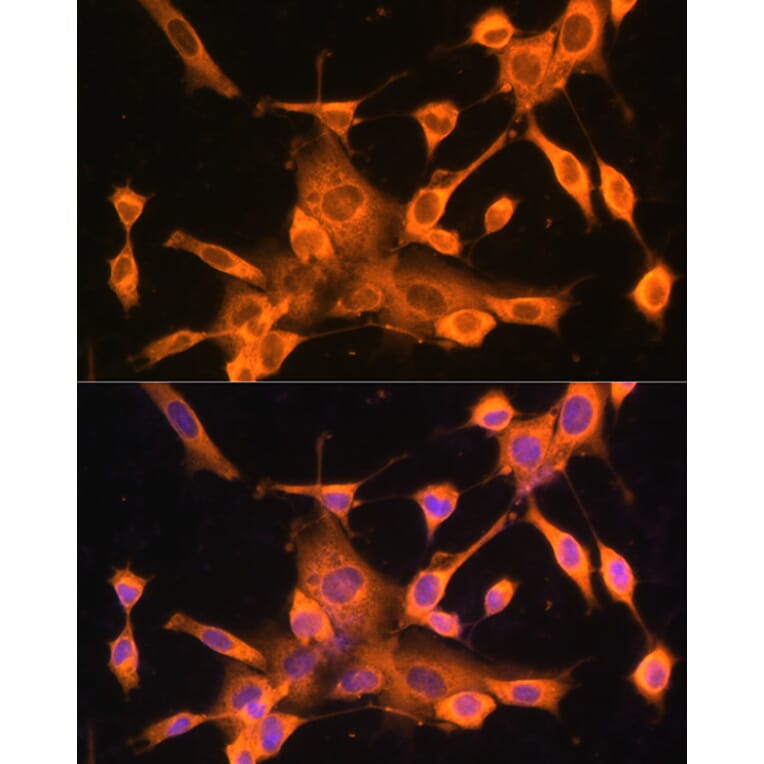 Immunofluorescence - Anti-FOXO3A Antibody (A11106) - Antibodies.com