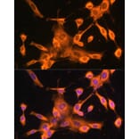 Immunofluorescence - Anti-FOXO3A Antibody (A11106) - Antibodies.com
