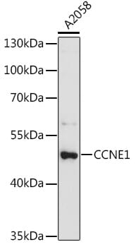 Western blot analysis of extracts of A2058 cells, using Anti-CCNE1 Antibody (A0112).
Secondary antibody: Goat Anti-Rabbit IgG (H+L) (HRP) (AS014) at 1:10,000 dilution.
Lysates / proteins: 25µg per lane.
Blocking buffer: 3% non-fat dry milk in TBST.