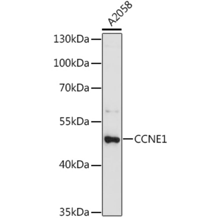 Western Blot - Anti-CCNE1 Antibody (A0112) - Antibodies.com