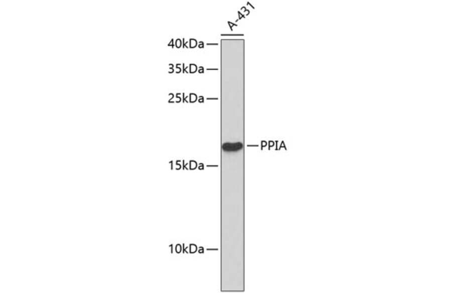 Western Blot - Anti-PPIA Antibody (A0113) - Antibodies.com