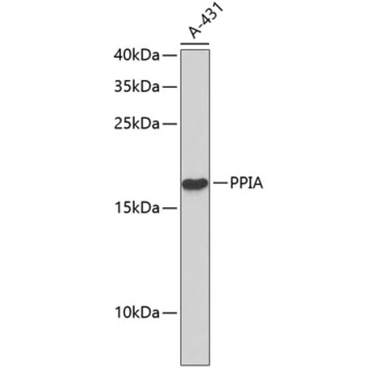 Western Blot - Anti-PPIA Antibody (A0113) - Antibodies.com