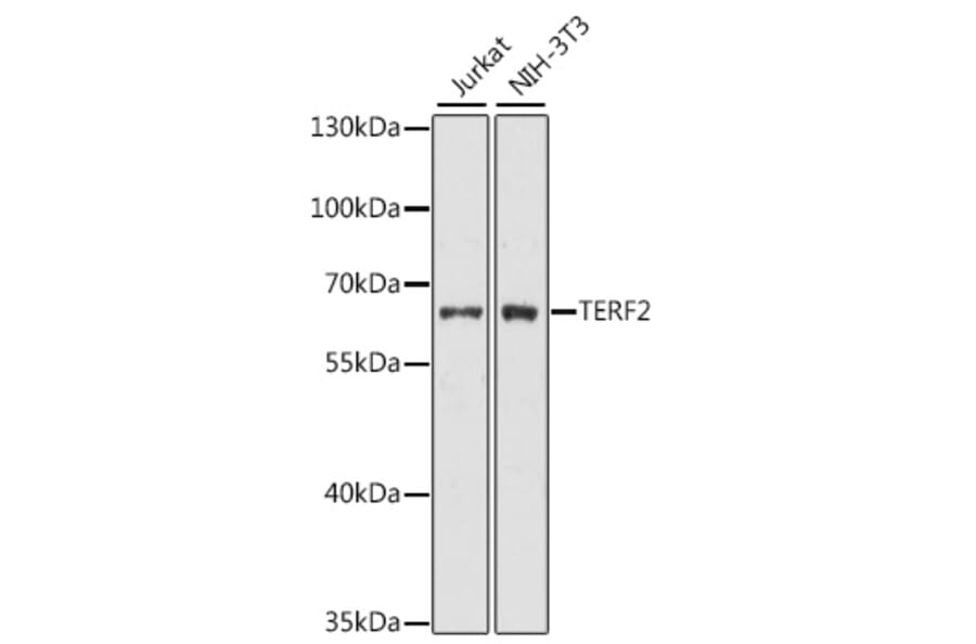 Western Blot - Anti-TERF2 Antibody (A0138) - Antibodies.com