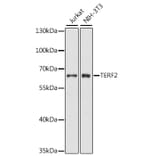 Western Blot - Anti-TERF2 Antibody (A0138) - Antibodies.com