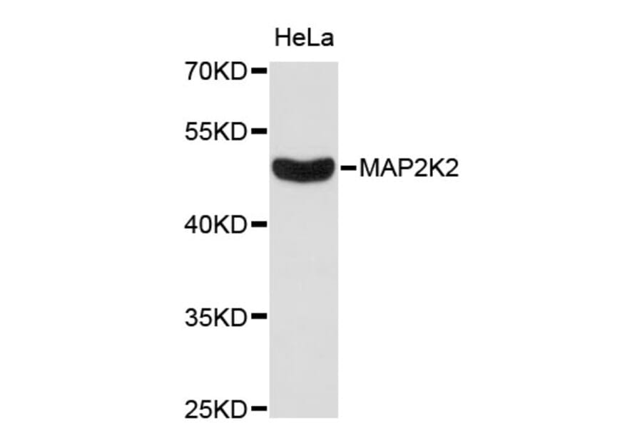 Western Blot - Anti-MAP2K2 Antibody (A0143) - Antibodies.com