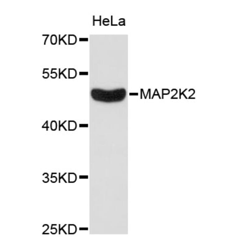 Western Blot - Anti-MAP2K2 Antibody (A0143) - Antibodies.com